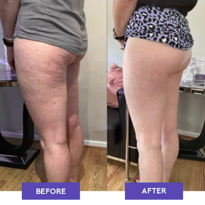 FasciaPro™ Rolling Percussive Massager