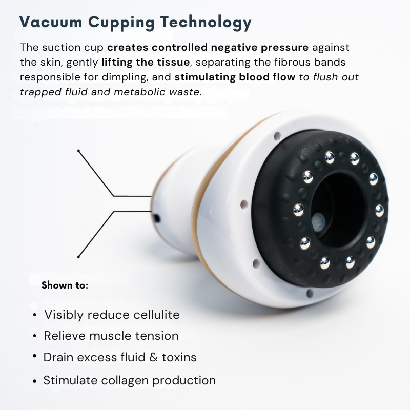 SculptLift Pro™ — Cellulite Vacuum Massager