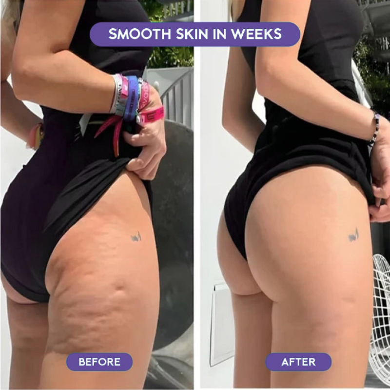 FasciaPro™ Rolling Percussive Massager