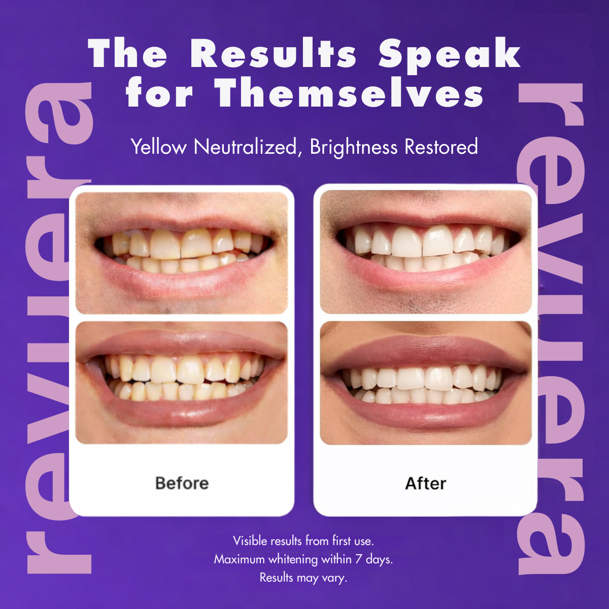 ToneCorrect™ - Purple Tooth Whitening Strips